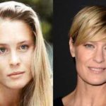 Robin Wright plastic surgery before and after photos