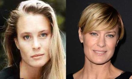 The naked truth about Robin Wright Plastic Surgery procedures
