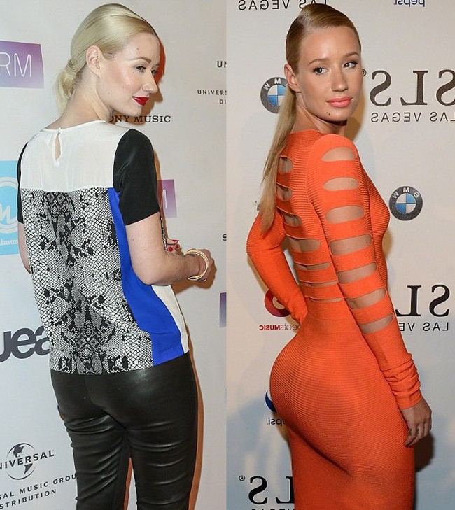 Iggy-Azalea-before-and-after-alleged-butt-implants.jpg