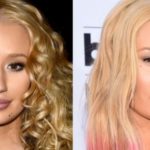 Iggy Azalea before and after nose job and chin implants 150x150