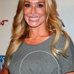 Taylor Armstrong plastic surgeries