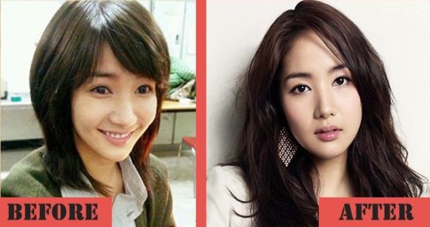 Park Min Young Gets A Plastic Surgery To Boost Her Career