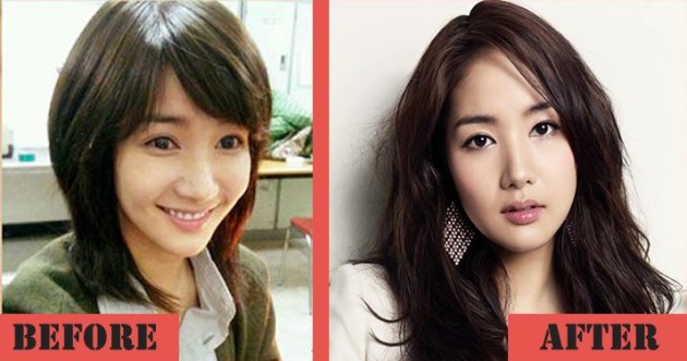 Park Min Young Gets A Plastic Surgery To Boost Her Career