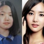 Park Min Young Before And After Plastic Surgery