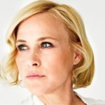 Patricia Arquette After Botox Injections 150x150