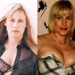 Patricia Arquette Before And After Plastic Surgery