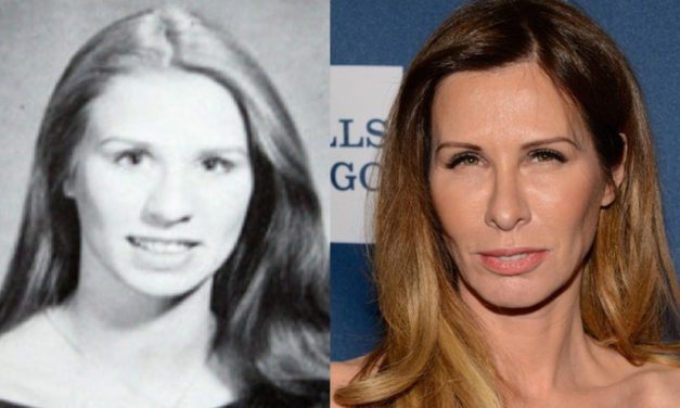 The Secrets of Carole Radziwill Plastic Surgery