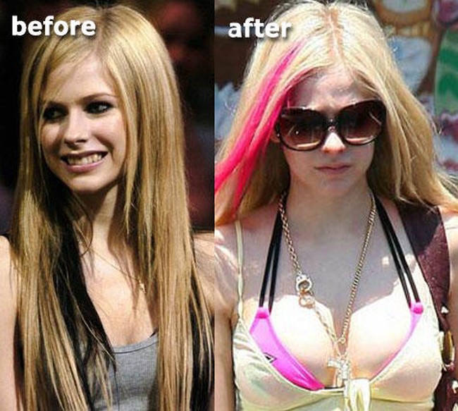 Breast Plastic Surgery 40