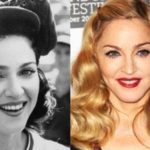 Has Madonna had a nose job plastic surgery