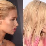 Iggy Azalea before and after nose job plastic surgery