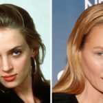 Uma Thurman Plastic Surgery Before and After