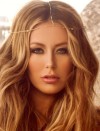 aubrey o’day plastic surgery
