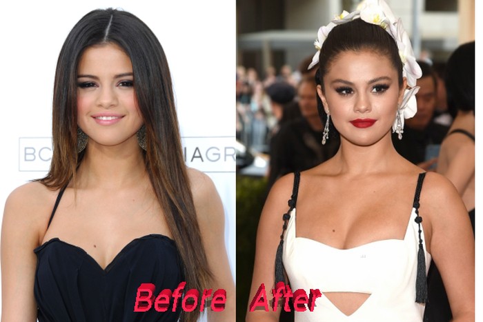 Selena Gomez Plastic Surgery or Special Make up? Really?