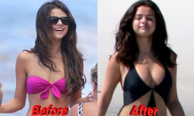 Selena Gomez Nose Job Plastic Surgery, Really?