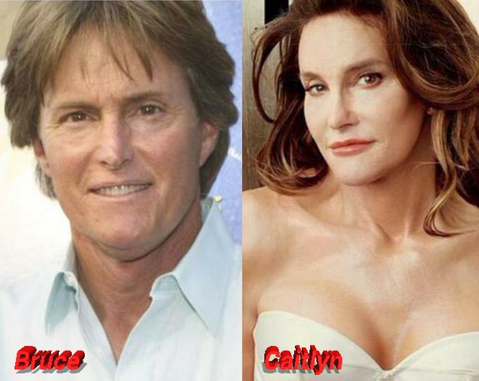 https://www.afterplasticsurgery.com/wp-content/uploads/2015/11/Bruce-Jenner-Caitlyn-...