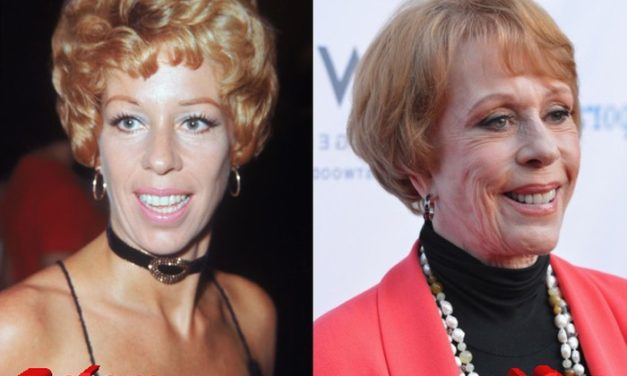 Carol Burnett’s Plastic Surgery: Unveiling the Transformation
