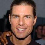 Tom Cruise teeth correction 1 150x150