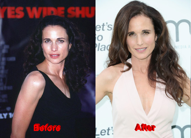 Andie MacDowell plastic surgery