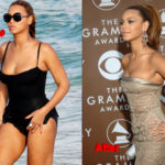 Beyoncé Plastic Surgery