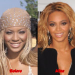 Beyoncé Plastic Surgery before and after_2