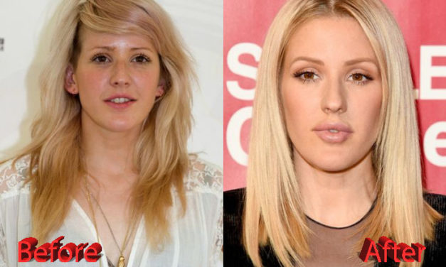 Ellie Goulding Plastic Surgery: Just Veggies?