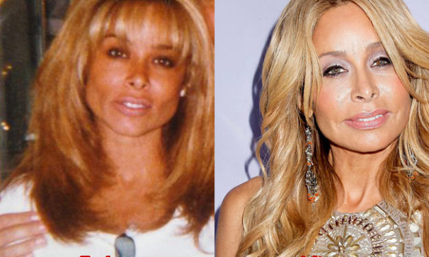 How Much Plastic Surgery has Faye Resnick Had?