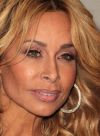 Faye Resnick Plastic Surgery