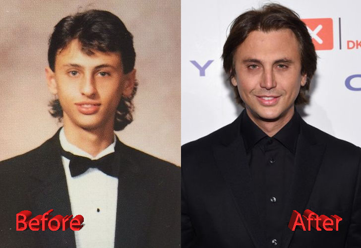 Jonathan Cheban Plastic Surgery: You Be The Judge.