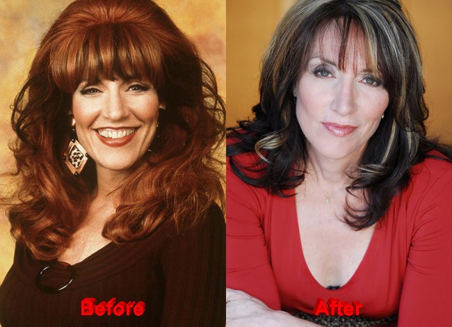 Katey Sagal Plastic Surgery Rumors?