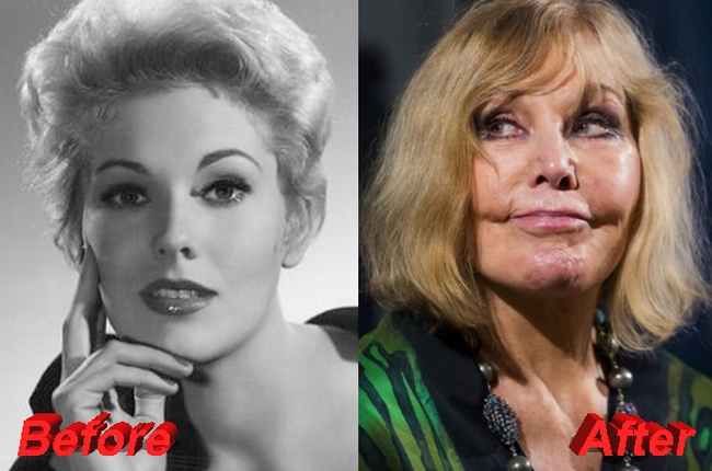 Kim Novak’s Bad Transformation After Plastic Surgery