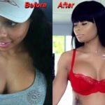 Blac Chyna before and after