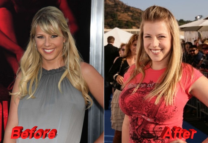 Looking at pictures before and after Jodie Sweetin plastic surgery, there i...