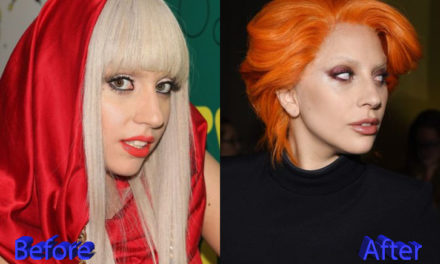 Lady Gaga Nose Job: A Multiple Plastic Surgery Procedures