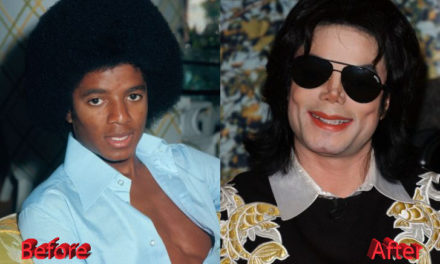 Michael Jackson Plastic Surgery: A Transformation