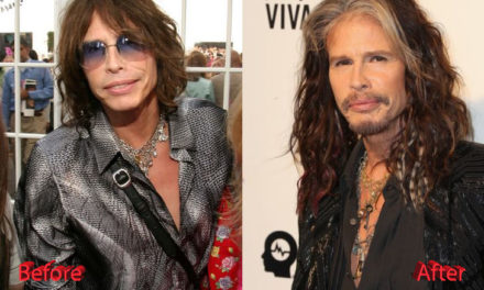 How Far Will Steven Tyler Go With Plastic Surgery?