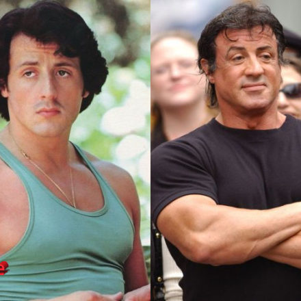 Sylvester Stallone Plastic Surgery Touch-ups
