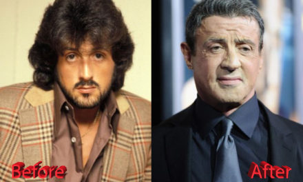 Sylvester Stallone Plastic Surgery Touch-ups