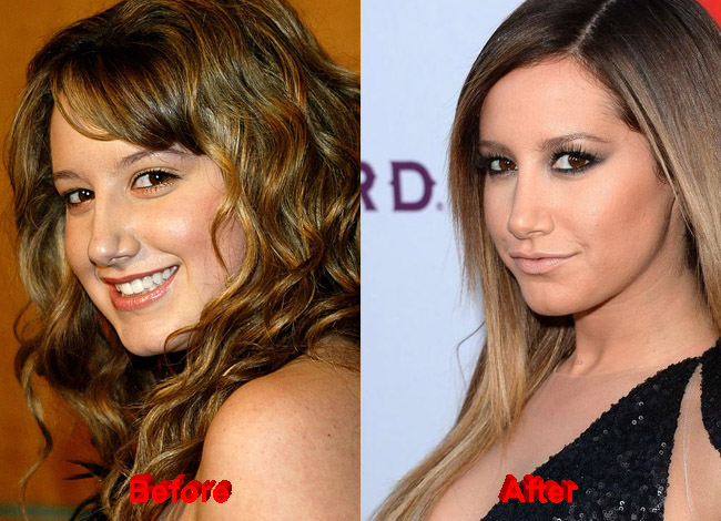 Speculations about Ashley Tisdale Nose Job