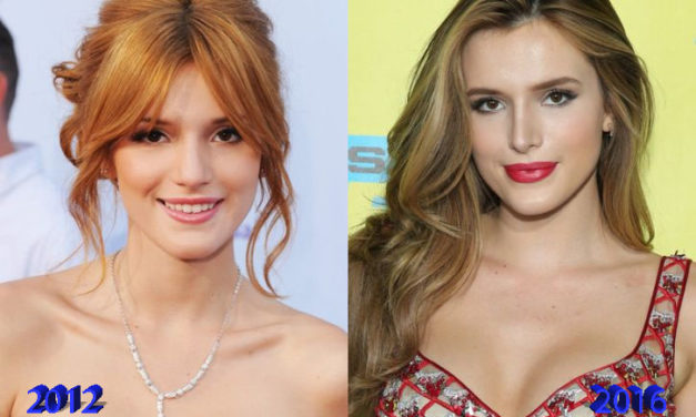 Bella Thorne Plastic Surgery: A Good Idea?