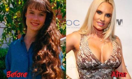 What Do You Think of Coco Austin Plastic Surgery?