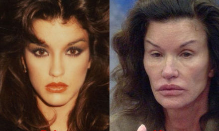 Janice Dickinson Plastic Surgery Horrible Results
