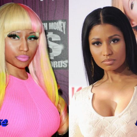 Nicki Minaj Plastic Surgery Procedures