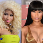 Nicki Minaj Before and After Surgery 150x150