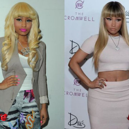 Nicki Minaj Plastic Surgery Procedures