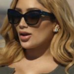 Nikki Mudarris After Lip Job