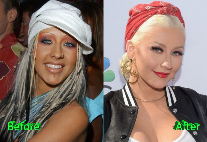 A Take on Christina Aguilera Plastic Surgery