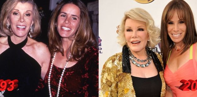 Joan Rivers Plastic Surgery – An Obsession