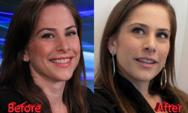 Ana Kasparian Nose Job: Before and After