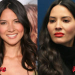 Olivia Munn Before and After Cosmetic Surgery