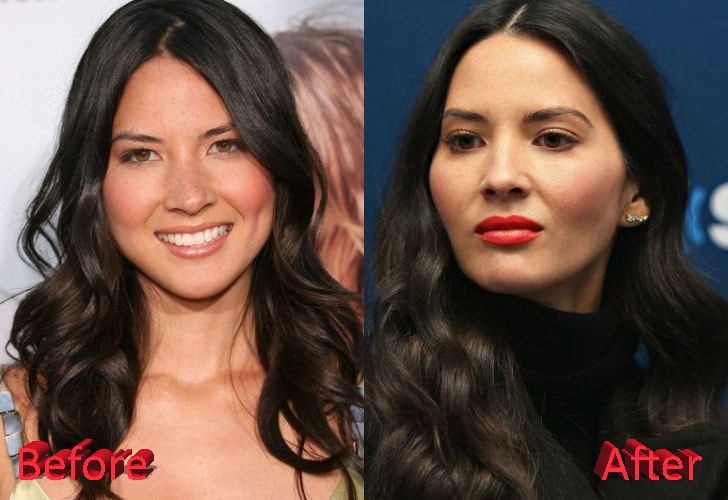 Olivia Munn Plastic Surgery: Just Gossips?